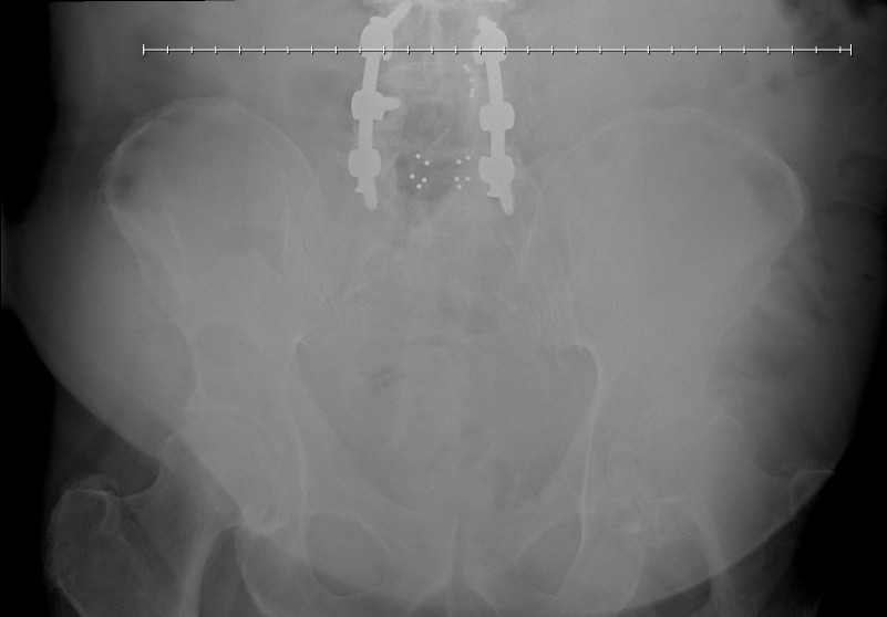 Hip2.jpg